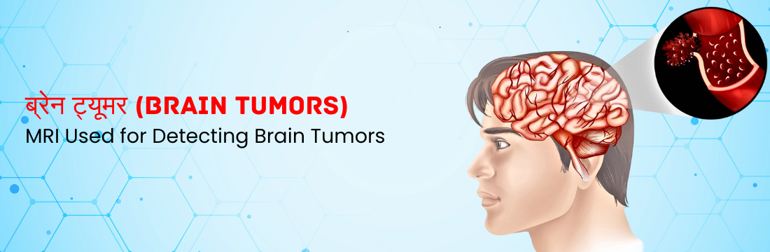 ब्रेन ट्यूमर का पता लगाने में MRI का महत्व